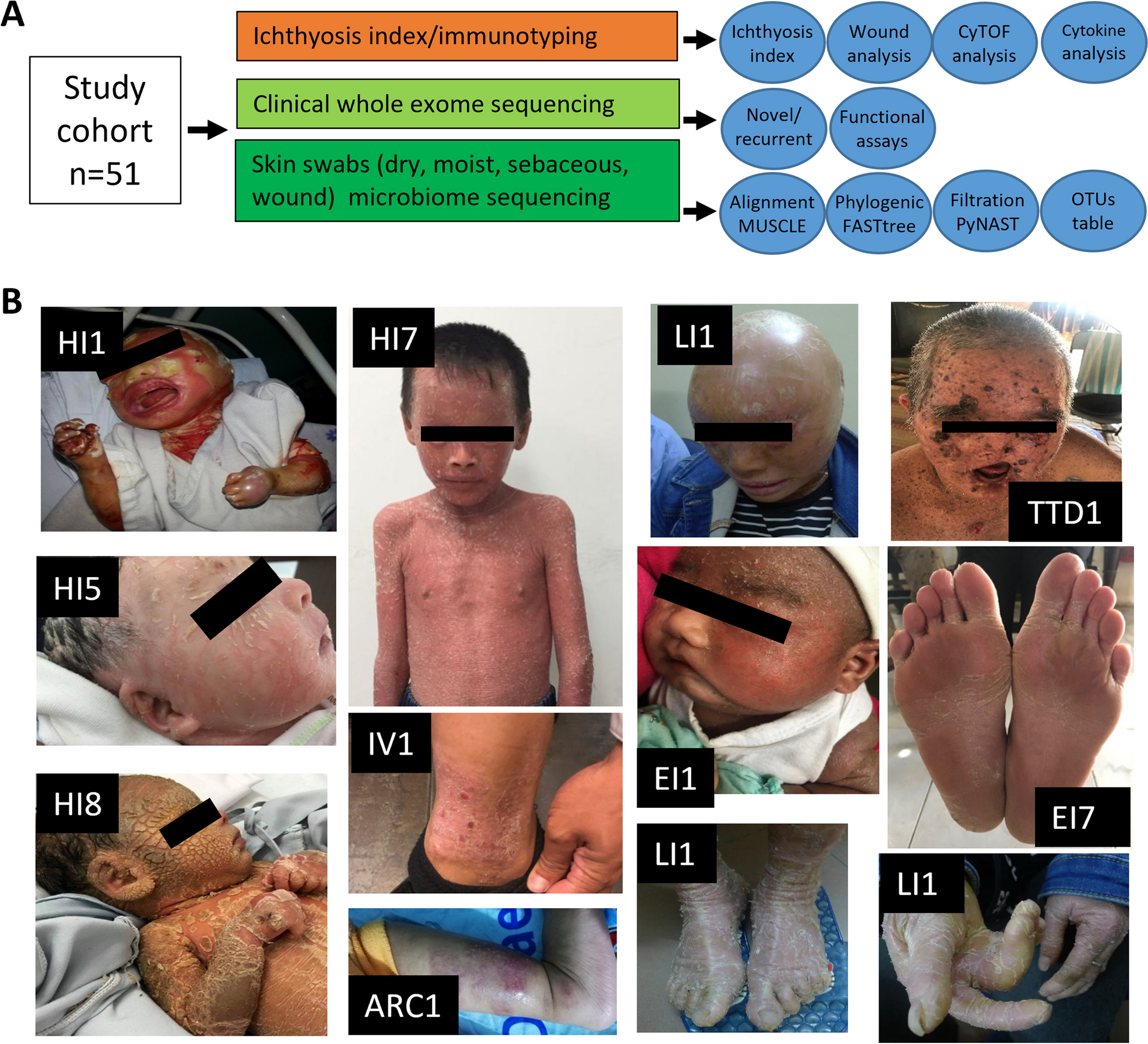 Altered skin microbiome, inflammation, and JAK/STAT signaling in Southeast Asian ichthyosis patients
