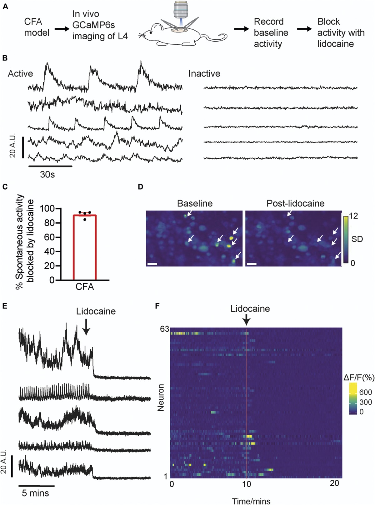 Assessing spontaneous sensory neuron activity using in vivo calcium imaging