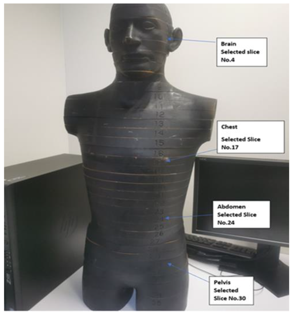 An investigation of internal scatter during computed tomography using an anthropomorphic phantom