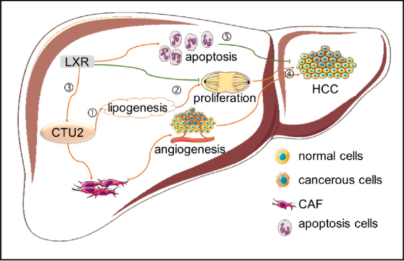 Activation of CTU2 expression by LXR promotes the development of hepatocellular carcinoma