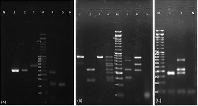 Yeast species in the respiratory samples of COVID-19 patients; molecular tracking of Candida auris