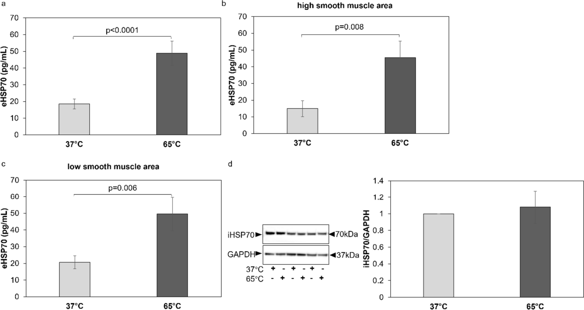 Heat-Induced Secretion of Heat Shock Proteins 70 and 90 Does not Affect the Expression of the Glucocorticoid Receptor in Primary Airway Cells in COPD