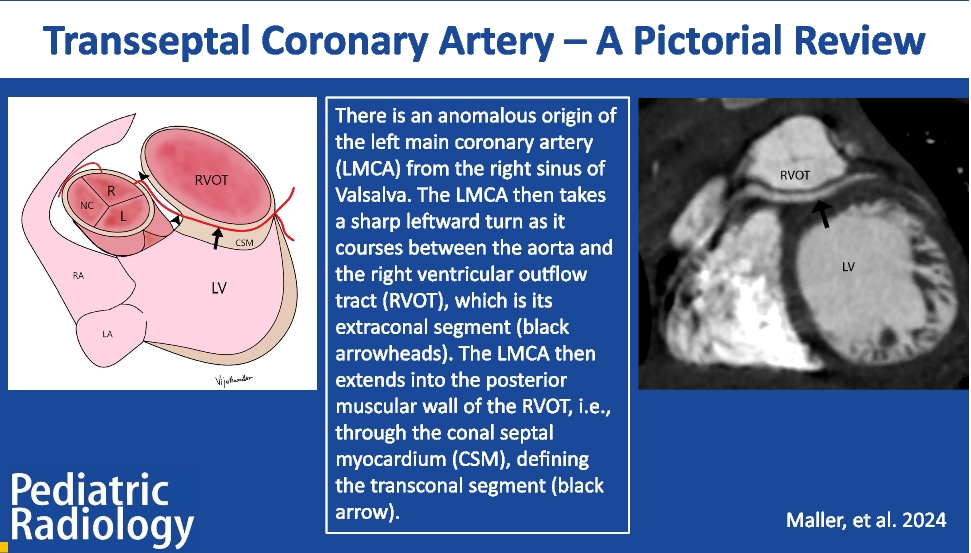 Transseptal coronary artery—a pictorial review