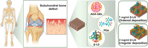 Architecture of β-Lactoglobulin Coating Modulates Bioinspired Alginate Dialdehyde-Gelatine/Polydopamine Scaffolds for Subchondral Bone Regeneration
