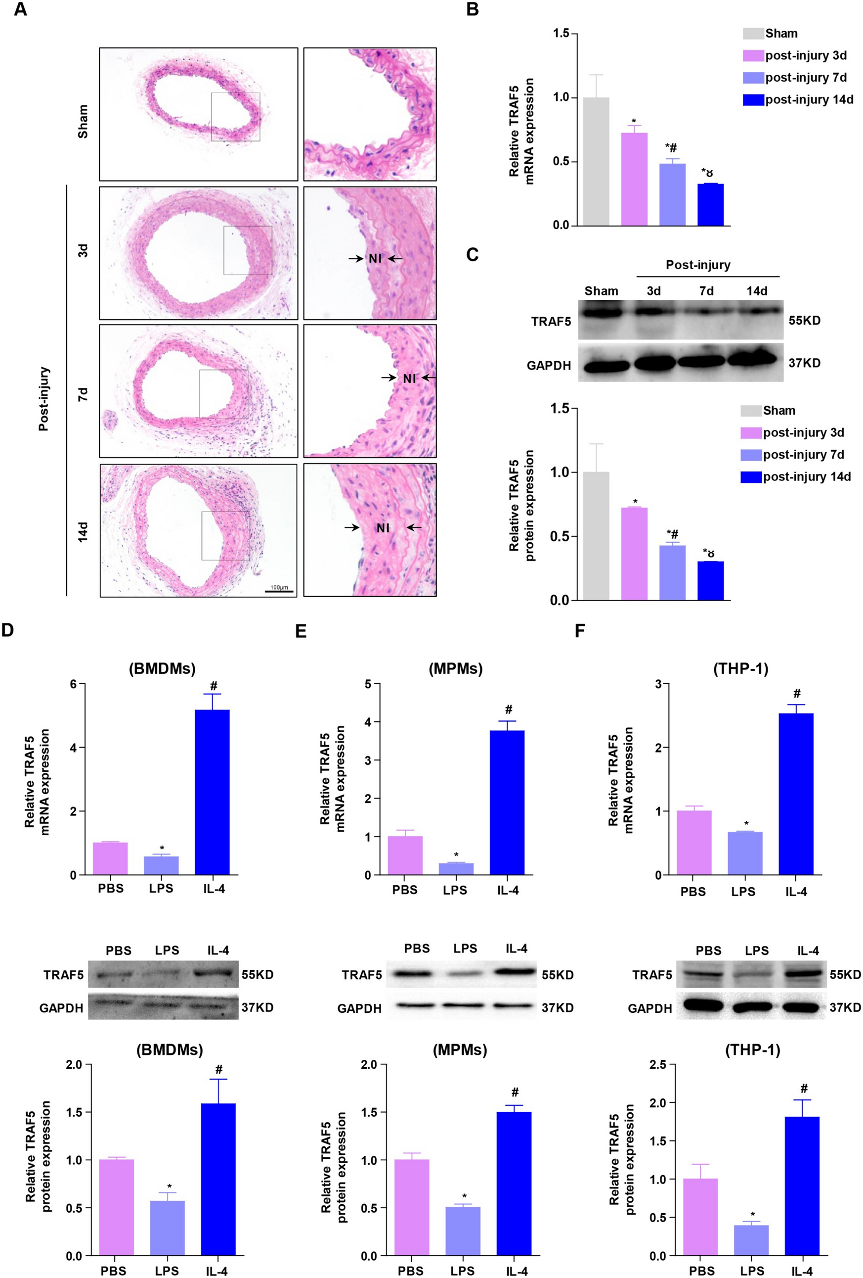 Tumor necrosis factor receptor-associated factor 5 protects against intimal hyperplasia by regulation of macrophage polarization via directly targeting PPARγ