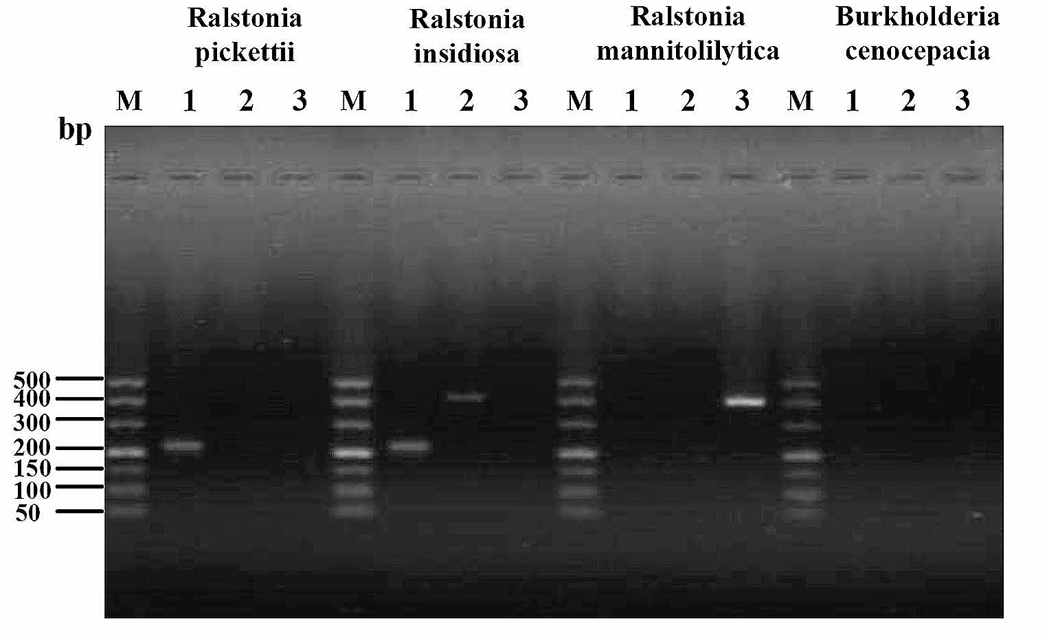 Molecular epidemiological and clinical infection characteristics analysis of Ralstonia