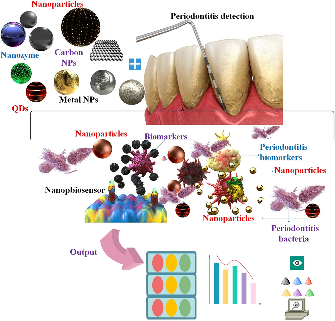 Recent advances in nanomaterial-based biosensor for periodontitis detection