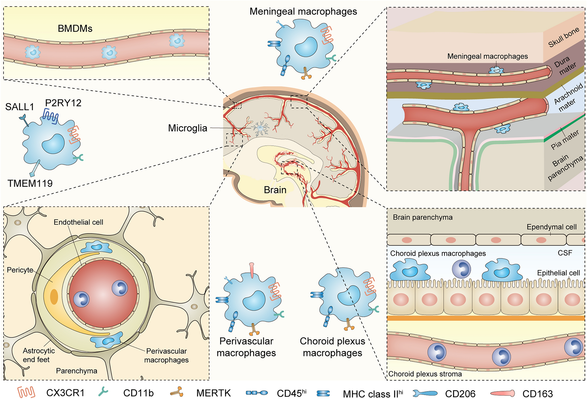 Microglia and macrophage metabolism: a regulator of cerebral gliomas