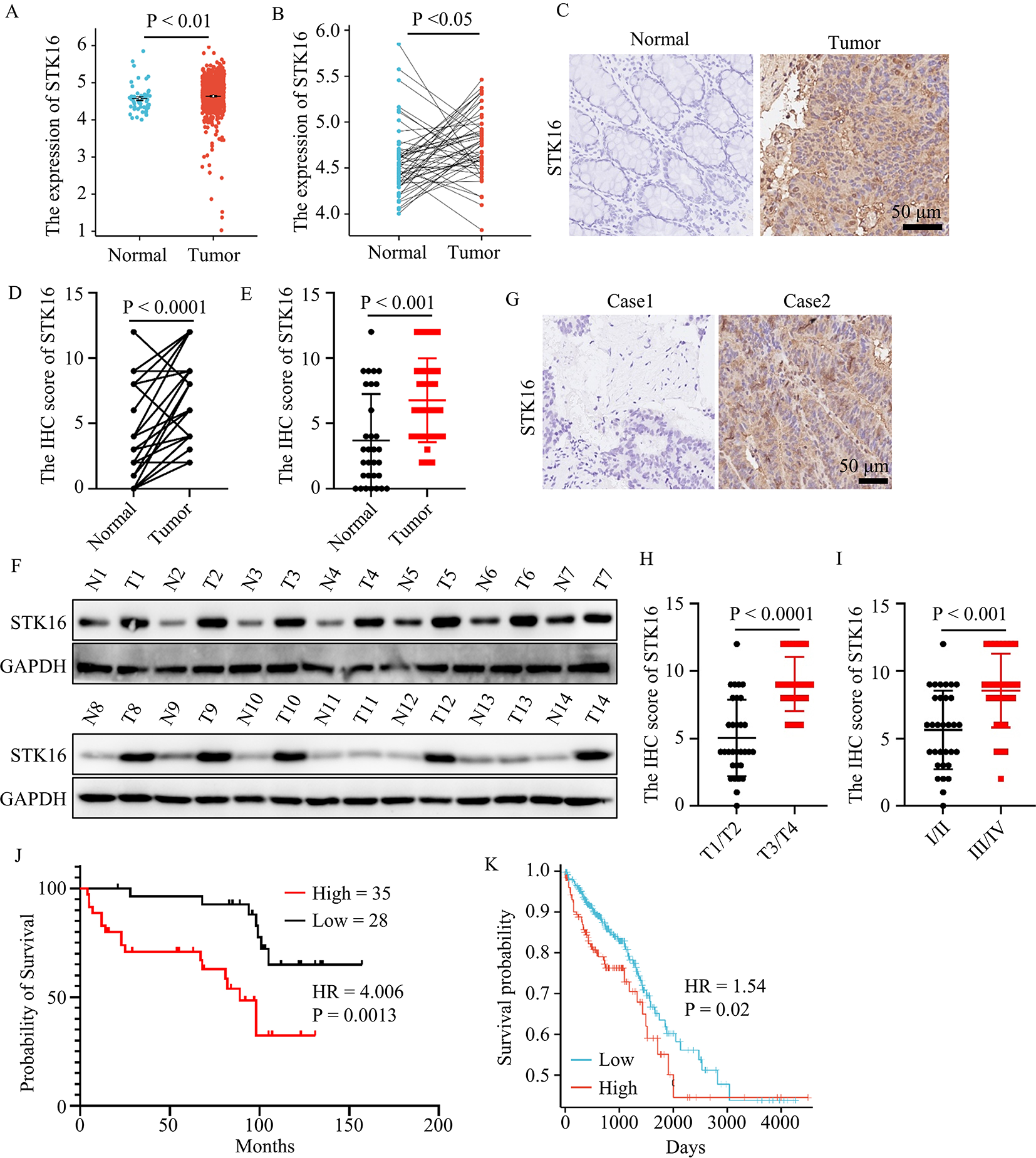 STK16 promoted colorectal cancer progress in a c-MYC signaling-dependent manner