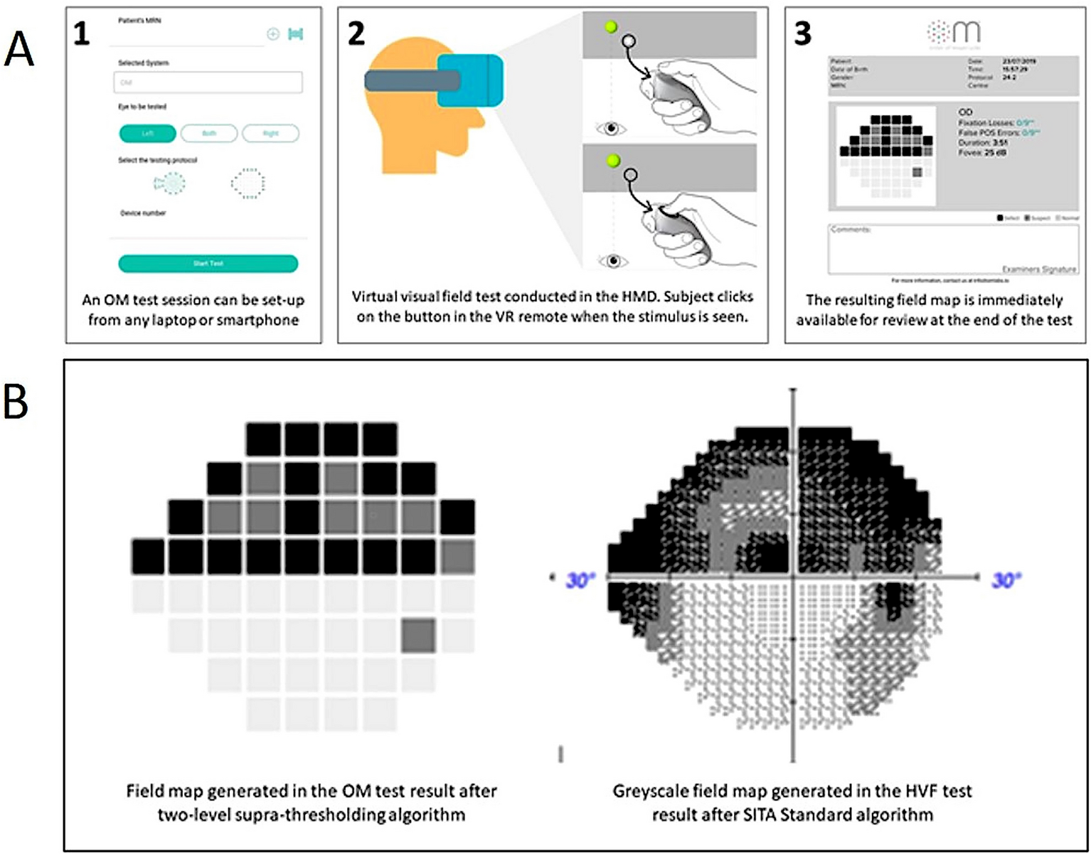 Development and evaluation of Order of Magnitude (OM): a virtual reality-based visual field analyzer for glaucoma detection