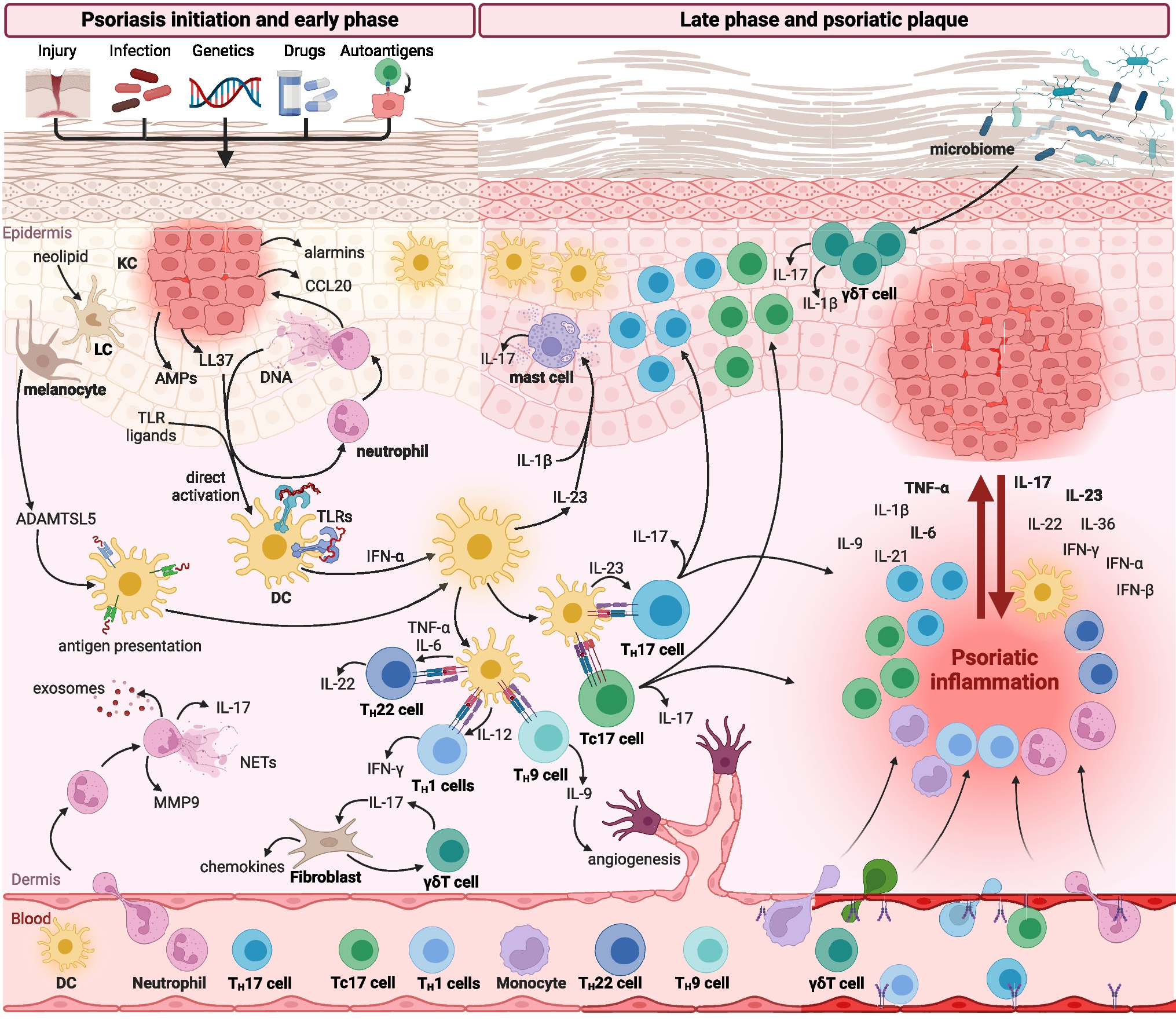 The Immunology of Psoriasis—Current Concepts in Pathogenesis