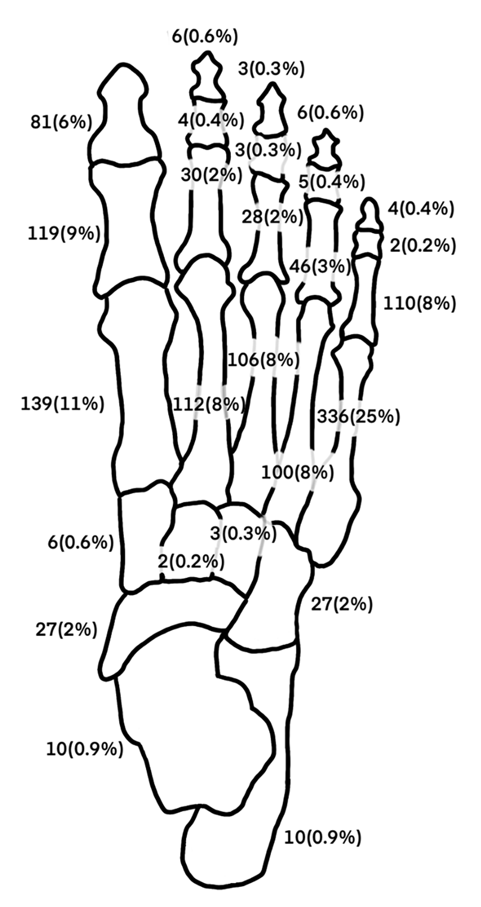 Pediatric foot fractures on radiographs: distribution and predictors of surgery