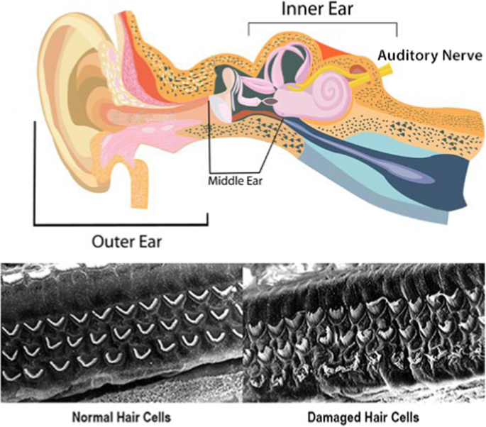 What is the safe noise exposure level to prevent noise-induced hearing loss?