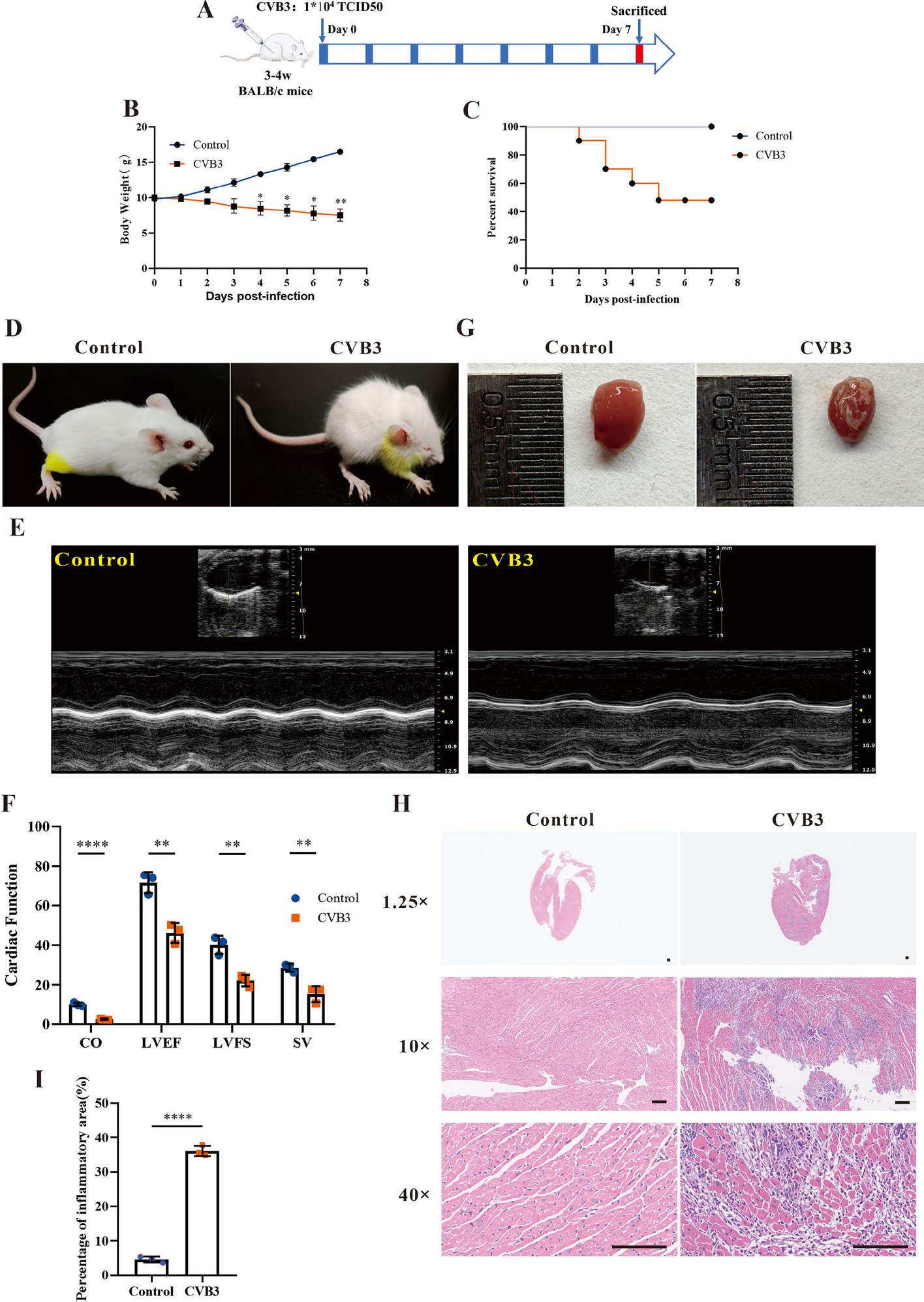miR-29b-3p regulates cardiomyocytes pyroptosis in CVB3-induced myocarditis through targeting DNMT3A