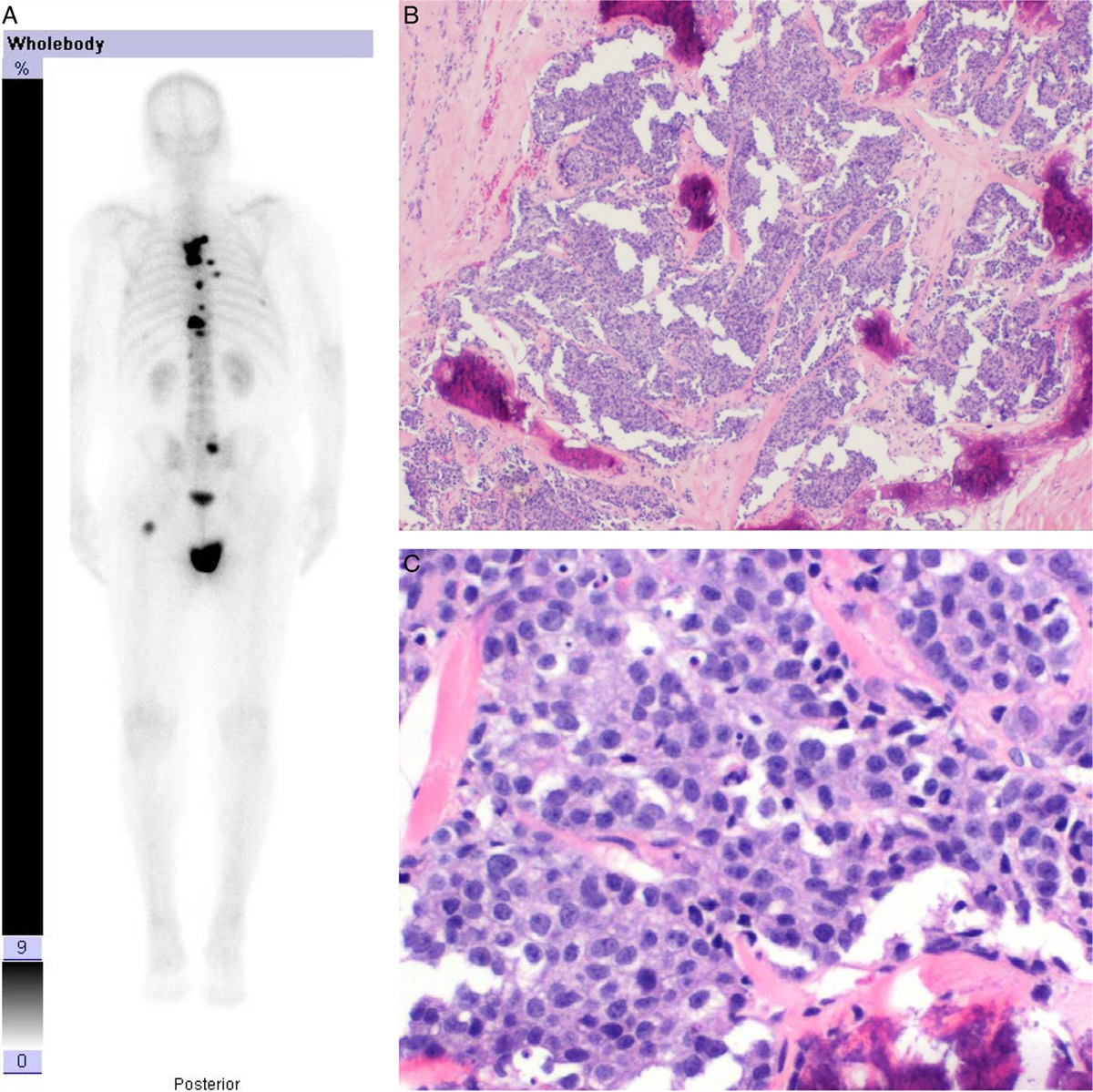 Contemporary Diagnostic Reporting for Prostatic Adenocarcinoma: Morphologic Aspects, Molecular Correlates, and Management Perspectives