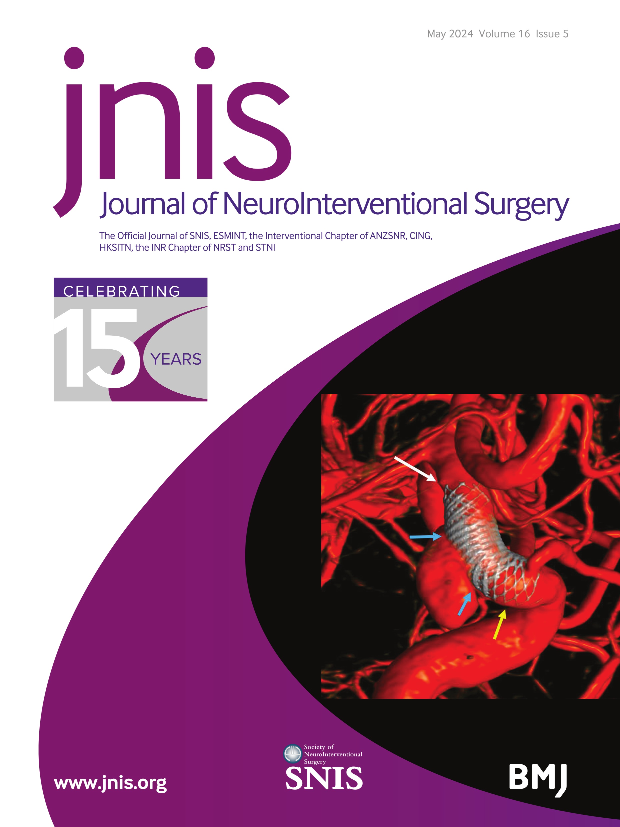 Predictors of aneurysm occlusion after treatment with flow diverters: a systematic literature review