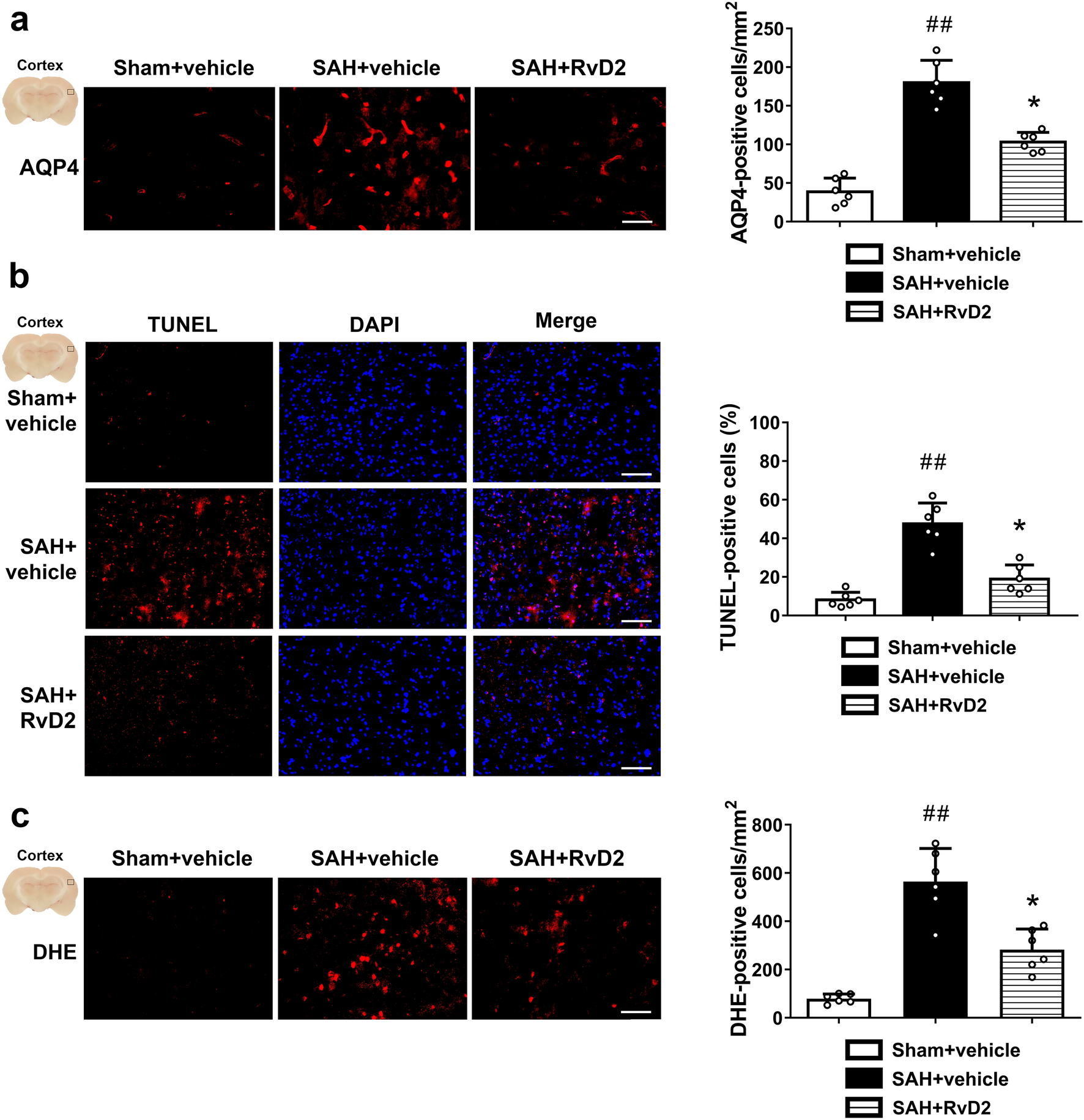 Correction: GPR18 Agonist Resolvin D2 Reduces Early Brain Injury in a Rat Model of Subarachnoid Hemorrhage by Multiple Protective Mechanisms