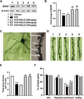 Sporoderm-removed Ganoderma lucidum spores ameliorated early depression-like behavior in a rat model of sporadic Alzheimer’s disease