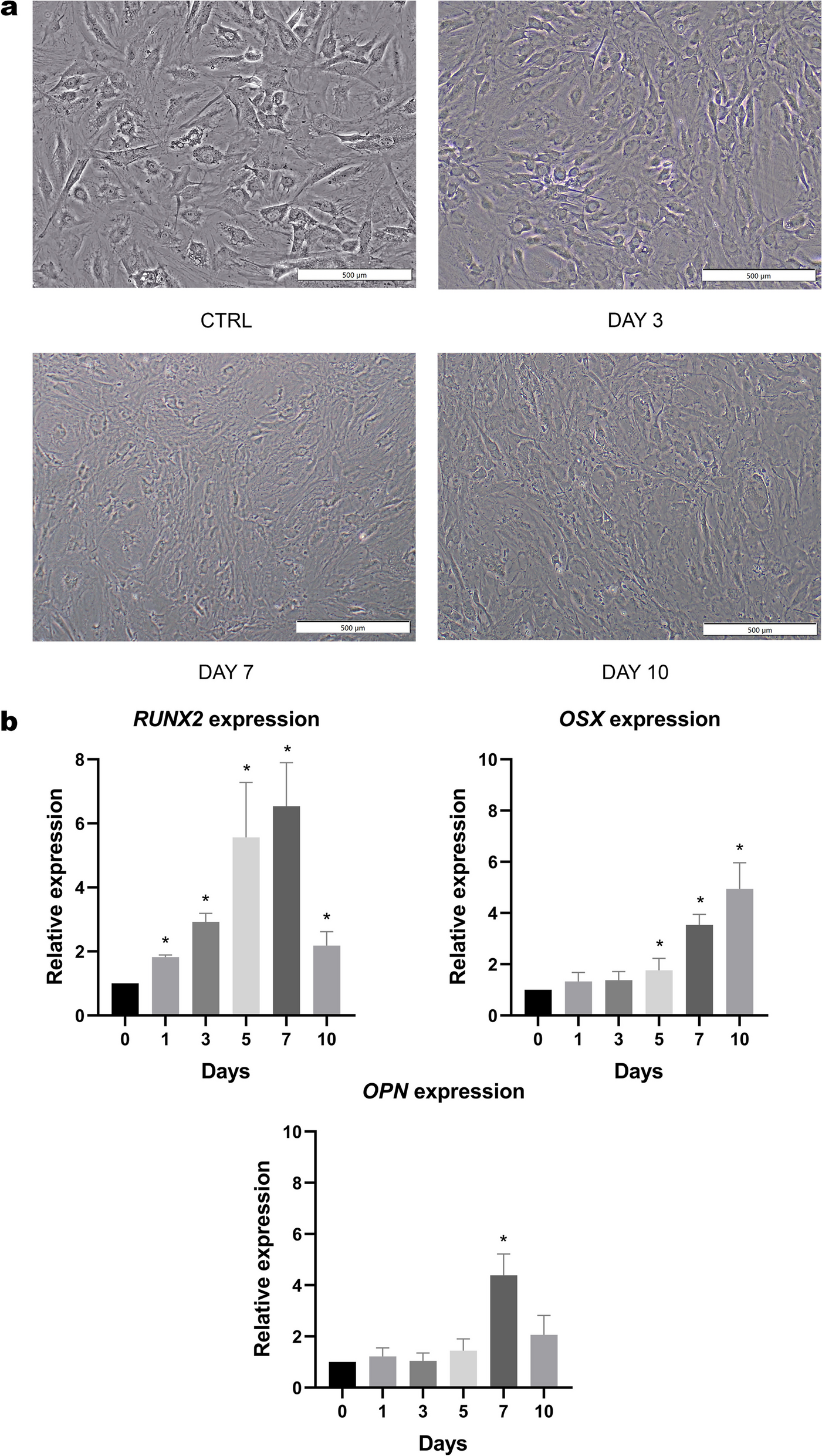 The extracts of osteoblast developed from adipose-derived stem cell and its role in osteogenesis