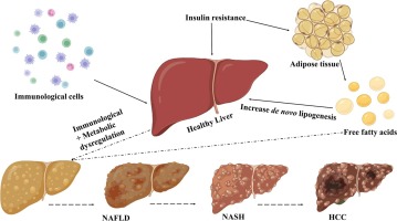 Comprehensive study of the interplay between immunological and metabolic factors in hepatic steatosis