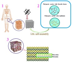 Evaluation of layer-by-layer assembly systems for drug delivery and antimicrobial properties in orthopaedic application