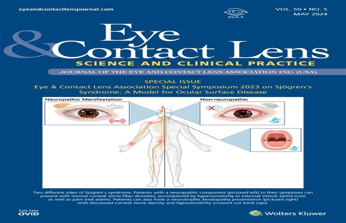 Inflammatory Dry Eye: Nerves, Microbiome, Onset, and New Treatments