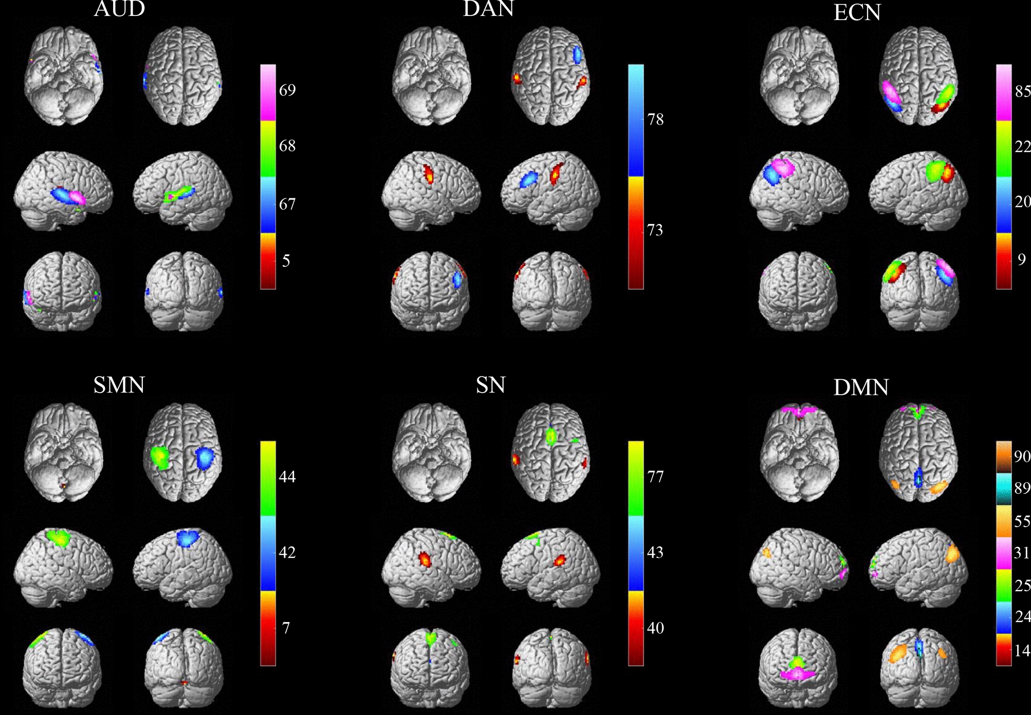 Altered patterns of dynamic functional connectivity of brain networks in deficit and non-deficit schizophrenia