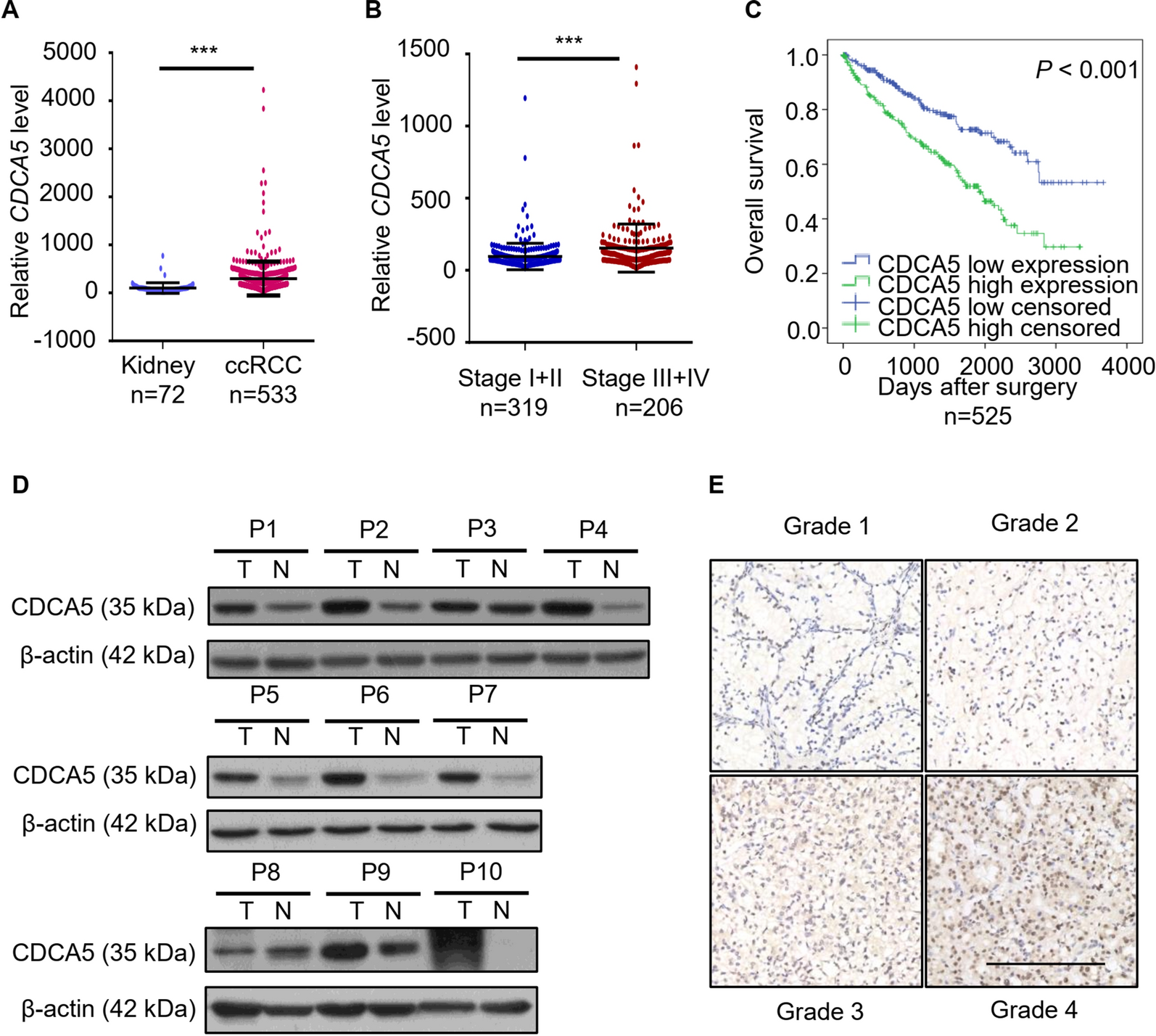 CDCA5-EEF1A1 interaction promotes progression of clear cell renal cell carcinoma by regulating mTOR signaling