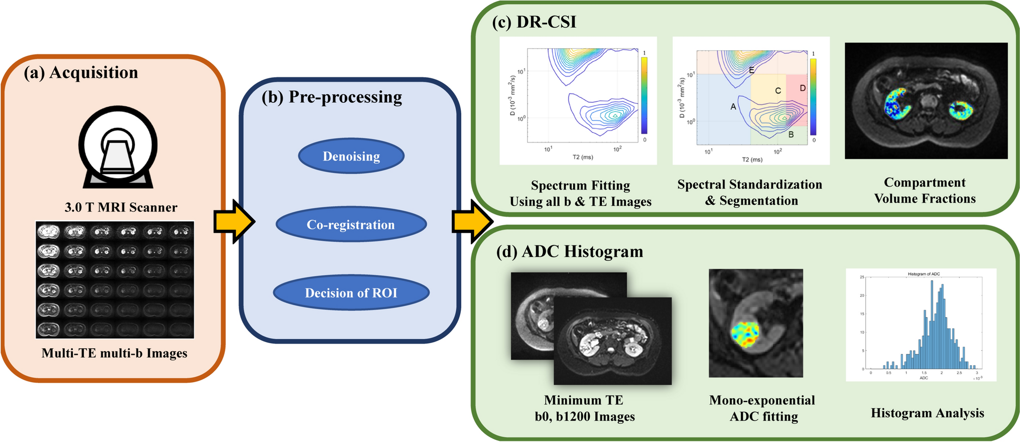 To characterize small renal cell carcinoma using diffusion relaxation correlation spectroscopic imaging and apparent diffusion coefficient based histogram analysis: a preliminary study