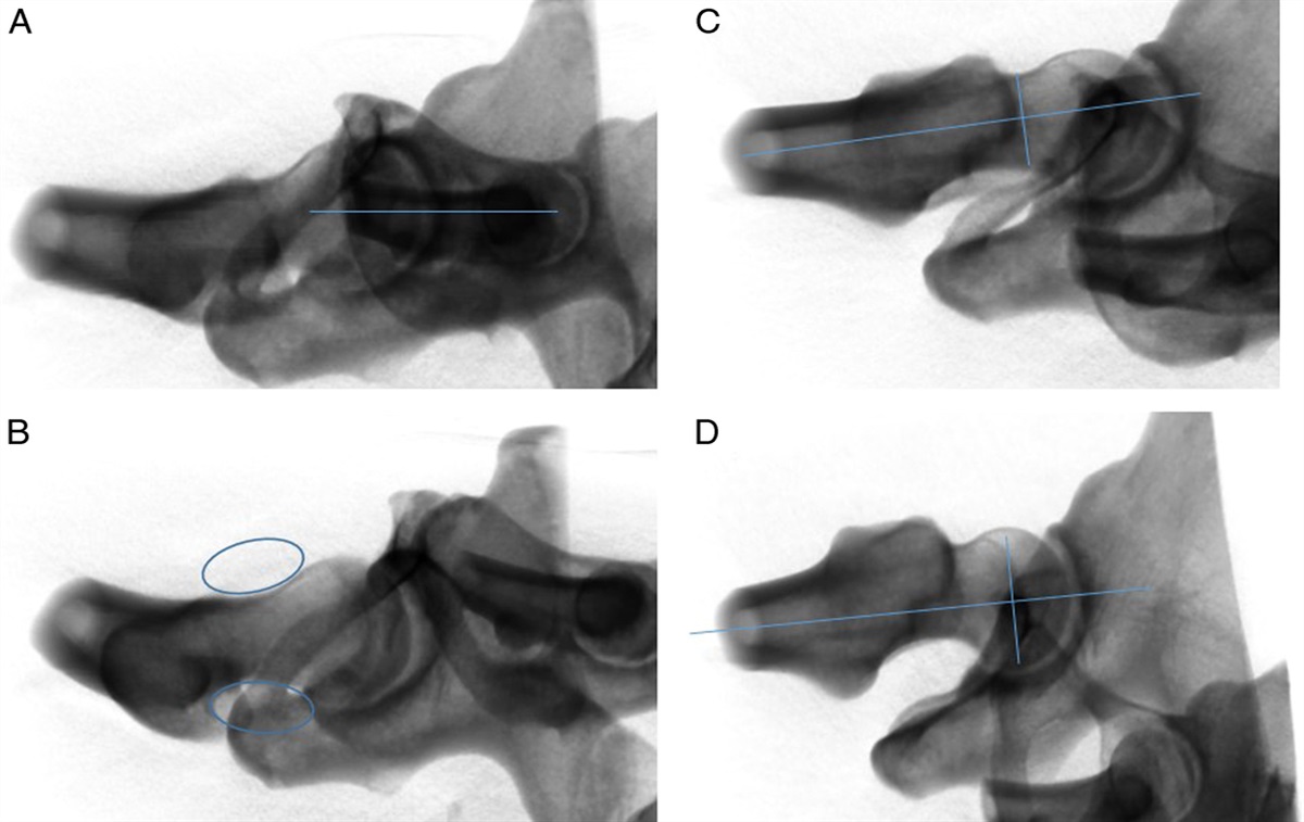 Multiple fluoroscopic views, including an external rotation-adduction view, are required to detect uncontained screws in the femoral neck