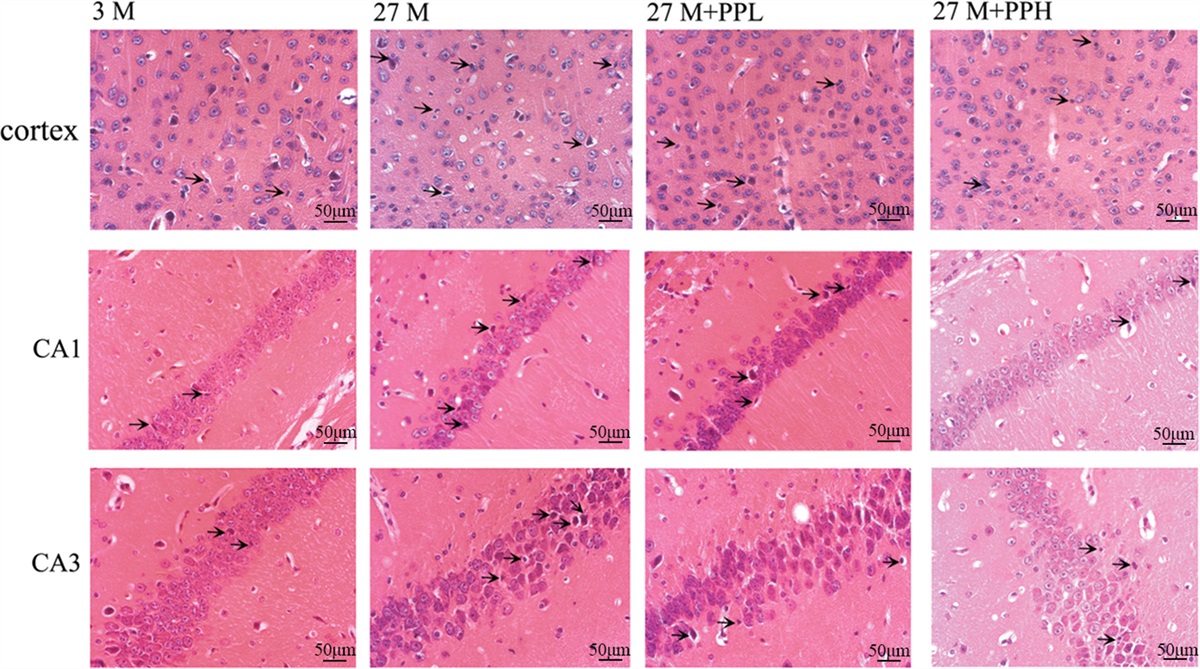 The polysaccharides from Balanophora polyandra enhanced neuronal autophagy to ameliorate brain function decline in natural aging mice through the PI3K/AKT/mTOR signaling pathway
