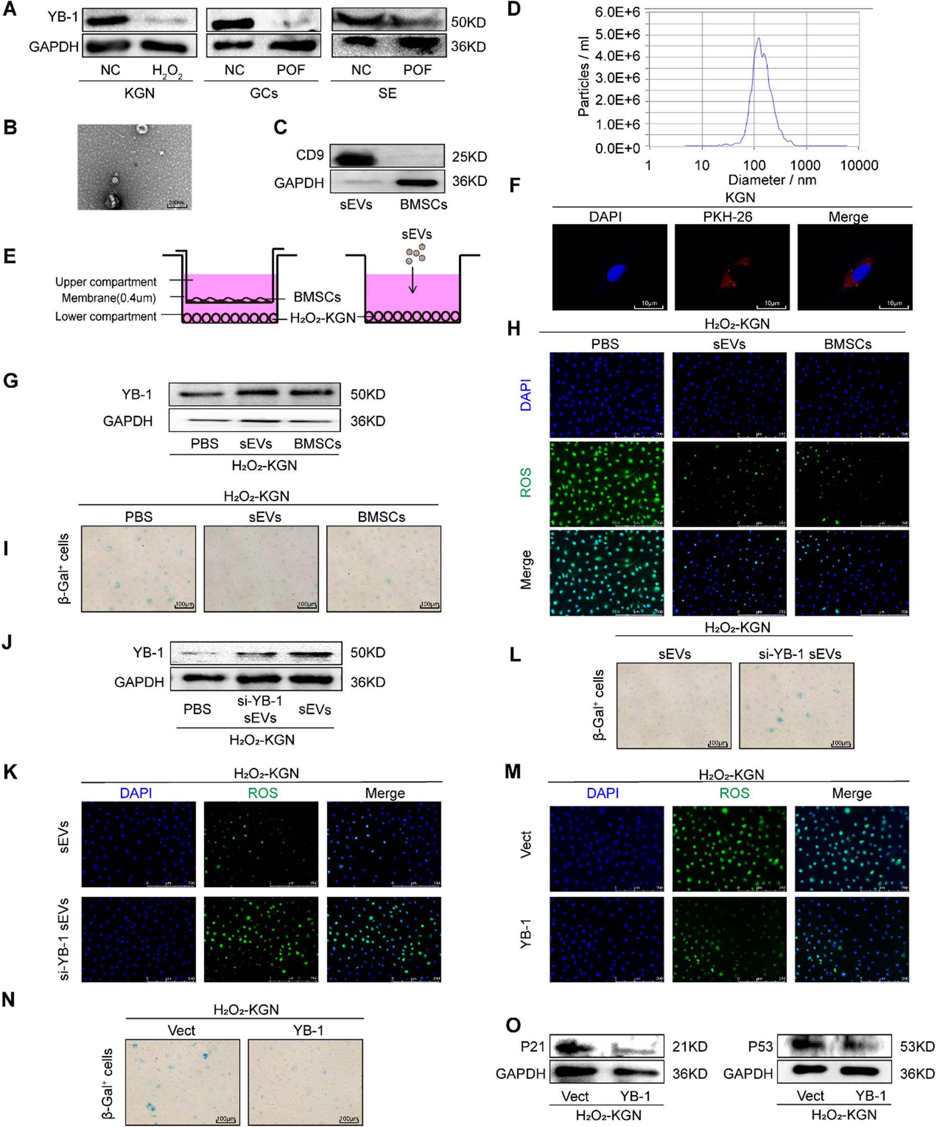 Exosomal YB-1 facilitates ovarian restoration by MALAT1/miR-211-5p/FOXO3 axis