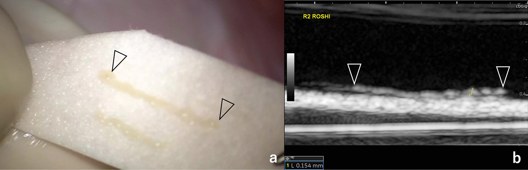 Feasibility of high-frequency ultrasound for seminiferous tubule assessment and correlation of B-mode imaging with pathological findings in the testis in azoospermia