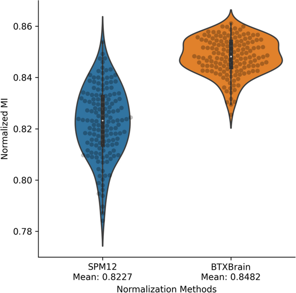 Clinical Performance Evaluation of an Artificial Intelligence-Powered Amyloid Brain PET Quantification Method