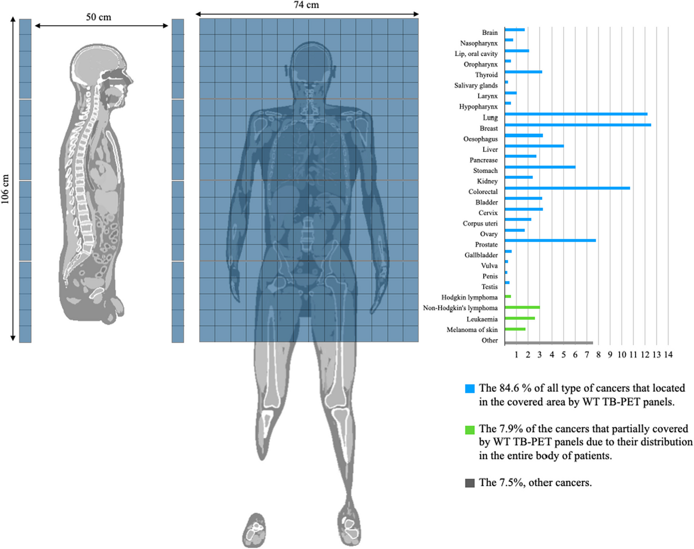 Evaluation of lesion contrast in the walk-through long axial FOV PET scanner simulated with XCAT anthropomorphic phantoms