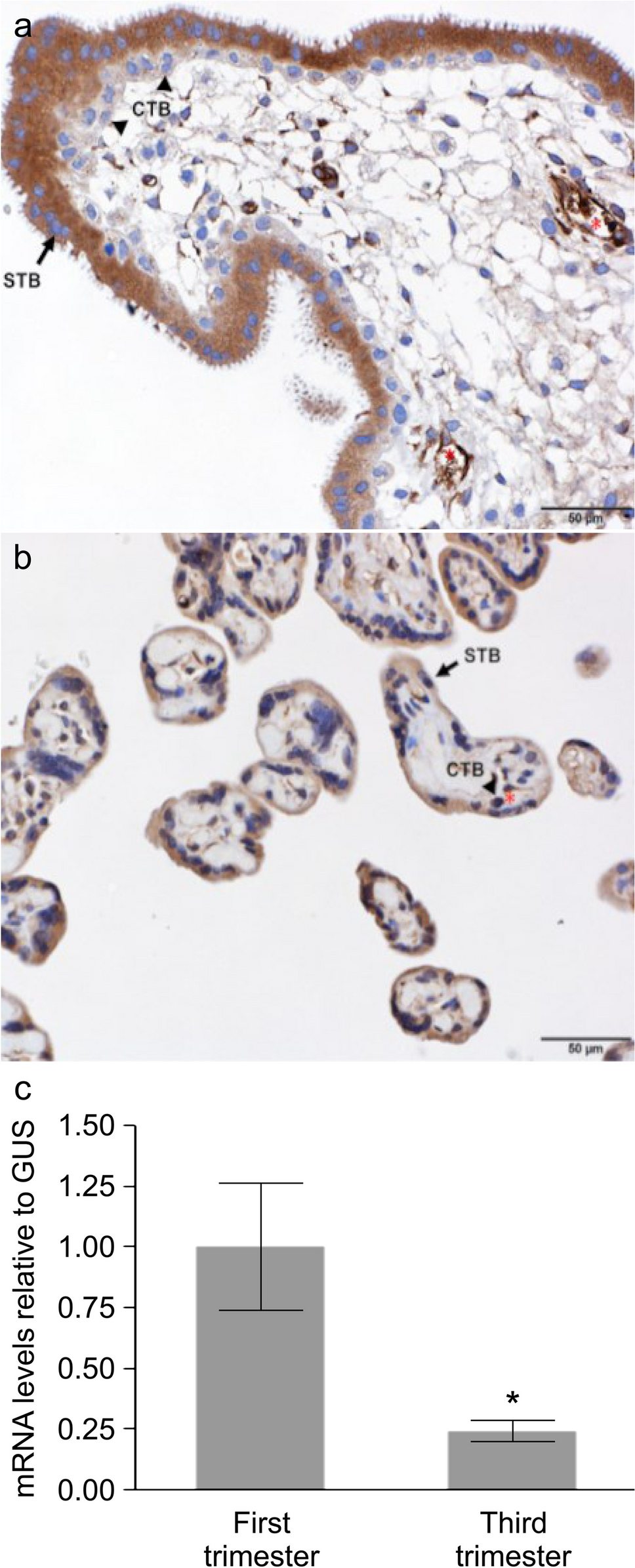 Downregulation of SPARC Expression Enhances the Fusion of BeWo Choriocarcinoma Cells