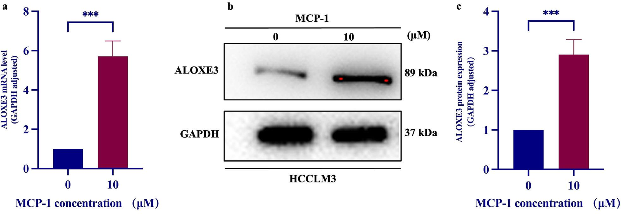 Anticancer Peptide MCP-1 Induces Ferroptosis in Liver Cancer HCCLM3 Cells by Targeting FOXM1/ALOXE3 Signal Pathway