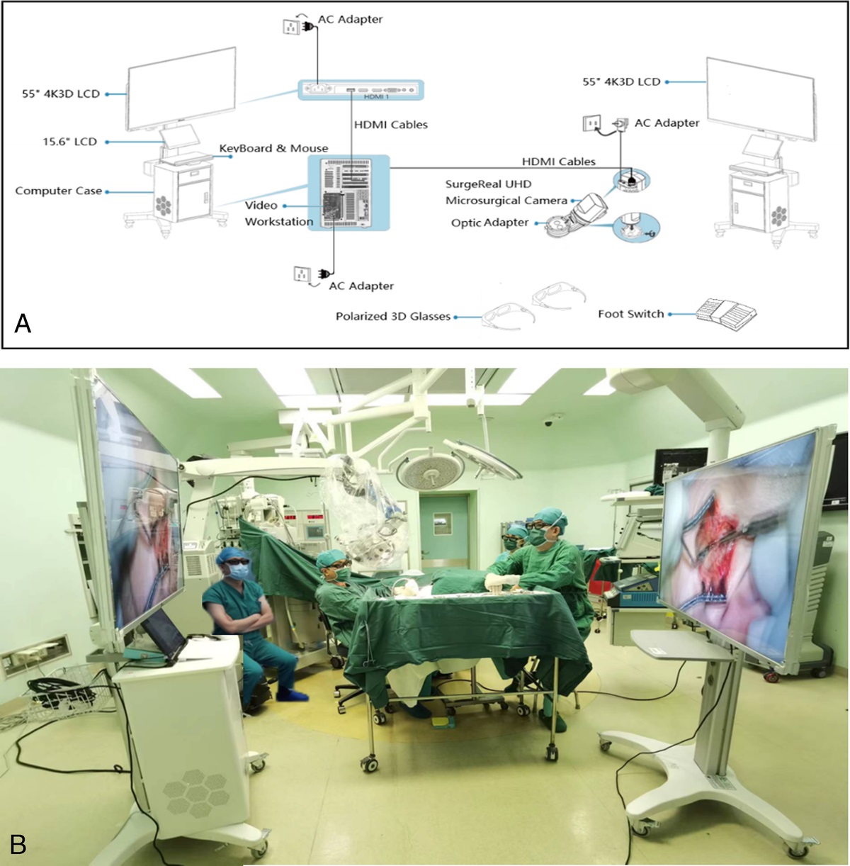 Clinical Application of the 4K-3D Exoscope System in Cochlear Implantation