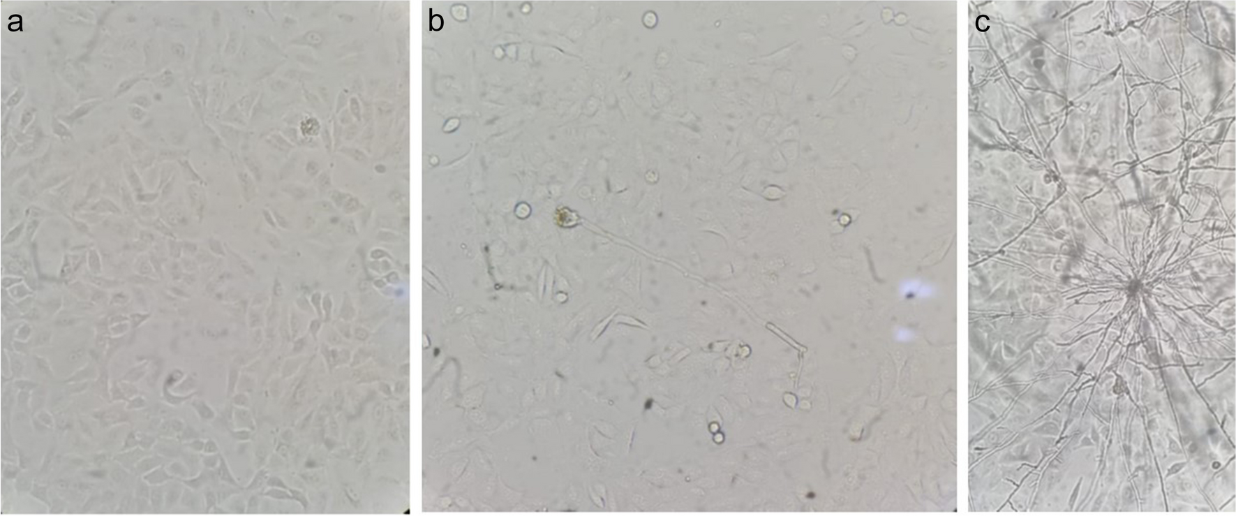 MicroRNA expression profile of alveolar epithelial cells infected with Aspergillus fumigatus