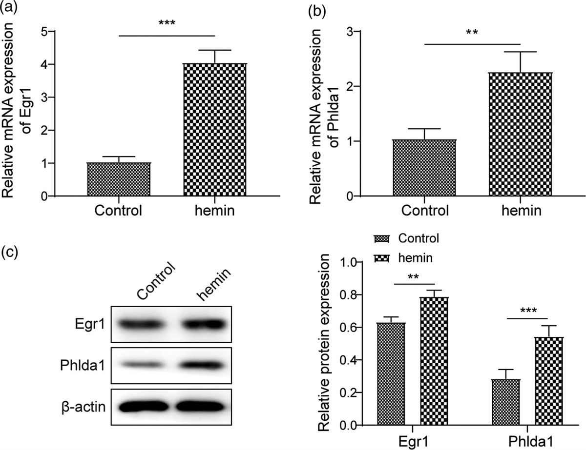 Egr1 promotes Nlrc4-dependent neuronal pyroptosis through phlda1 in an in-vitro model of intracerebral hemorrhage