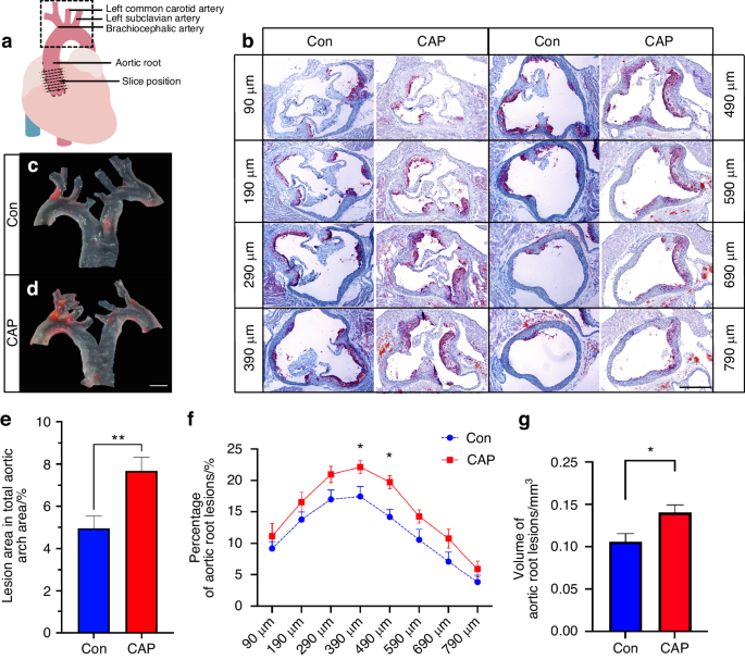 Unveiling the oral-gut connection: chronic apical periodontitis accelerates atherosclerosis via gut microbiota dysbiosis and altered metabolites in apoE−/− Mice on a high-fat diet