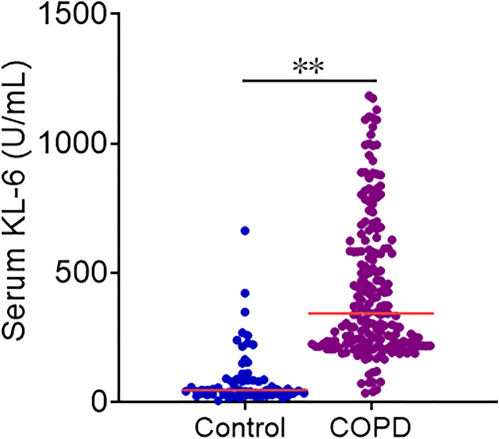 Associations of the Serum KL-6 with Severity and Prognosis in Patients with Acute Exacerbation of Chronic Obstructive Pulmonary Disease