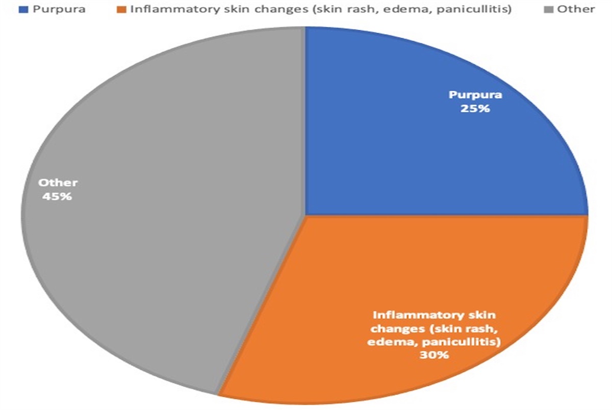 Skin Involvement: A Harbinger of Worse Prognosis in Patients With Sepsis