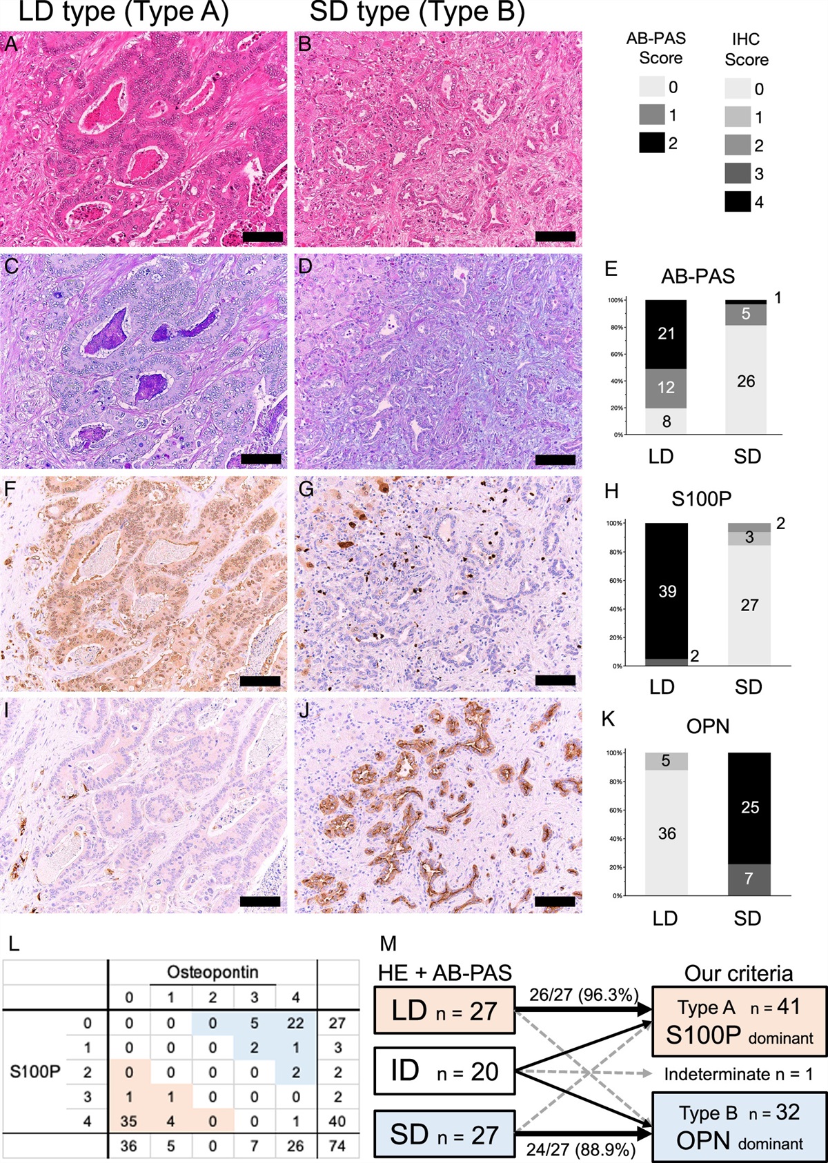 An Immunohistochemical Analysis of Osteopontin and S100 Calcium-binding Protein P is Useful for Subclassifying Large- and Small-duct Type Intrahepatic Cholangiocarcinomas