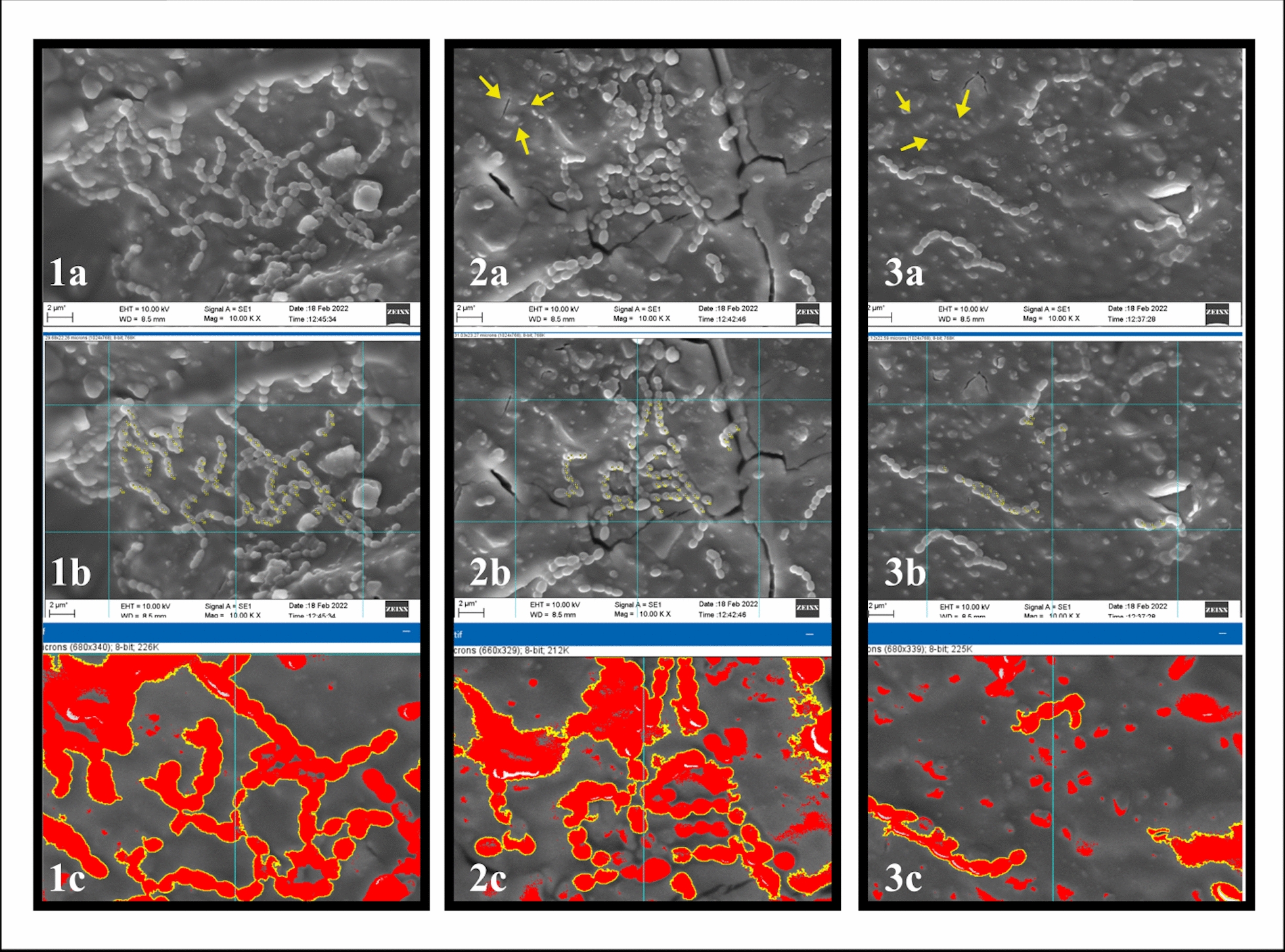 Addition of nisin to high-viscosity glass-ionomer cement: a comparative in vitro study on antibacterial and physical properties