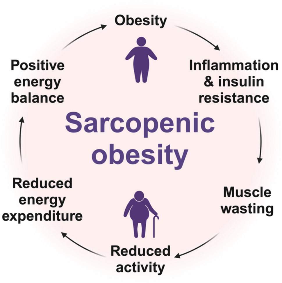 Sarcopenic Obesity and Cardiovascular Disease: An Overlooked but High-Risk Syndrome