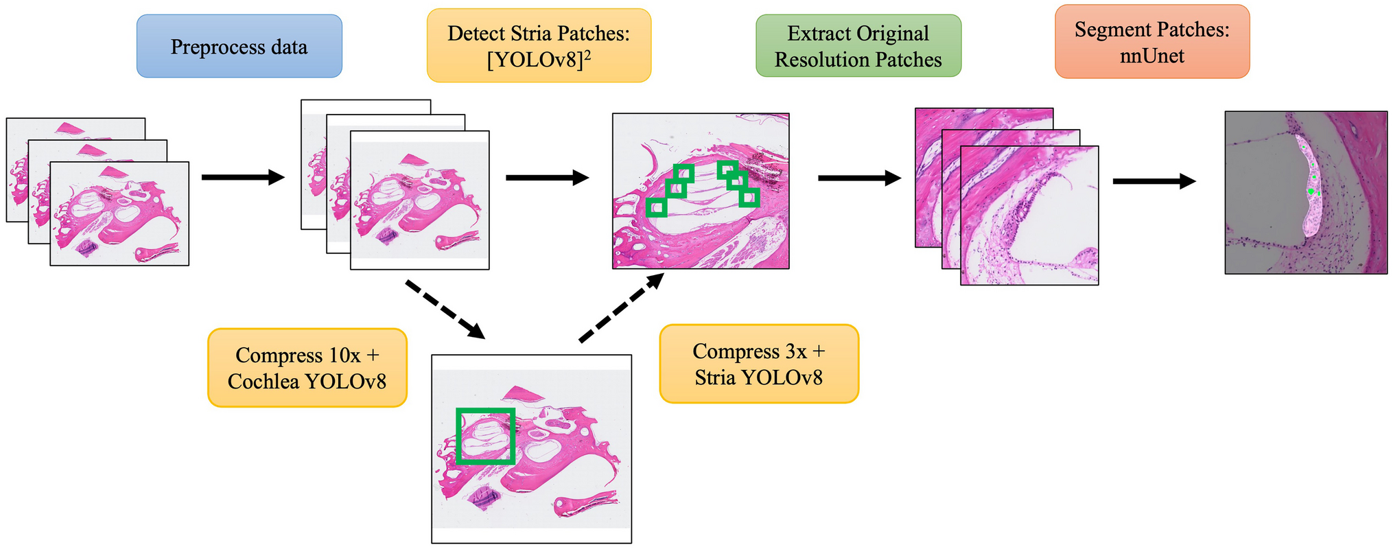 SVPath: A Deep Learning Tool for Analysis of Stria Vascularis from Histology Slides