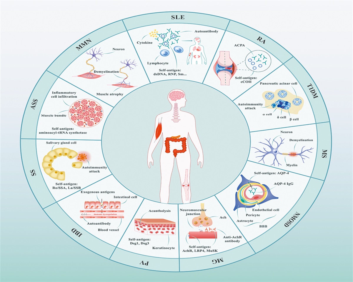 Dawn of CAR-T cell therapy in autoimmune diseases