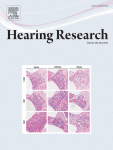 Hearing Loss-Related Altered Neuronal Activity in the Inferior Colliculus.
