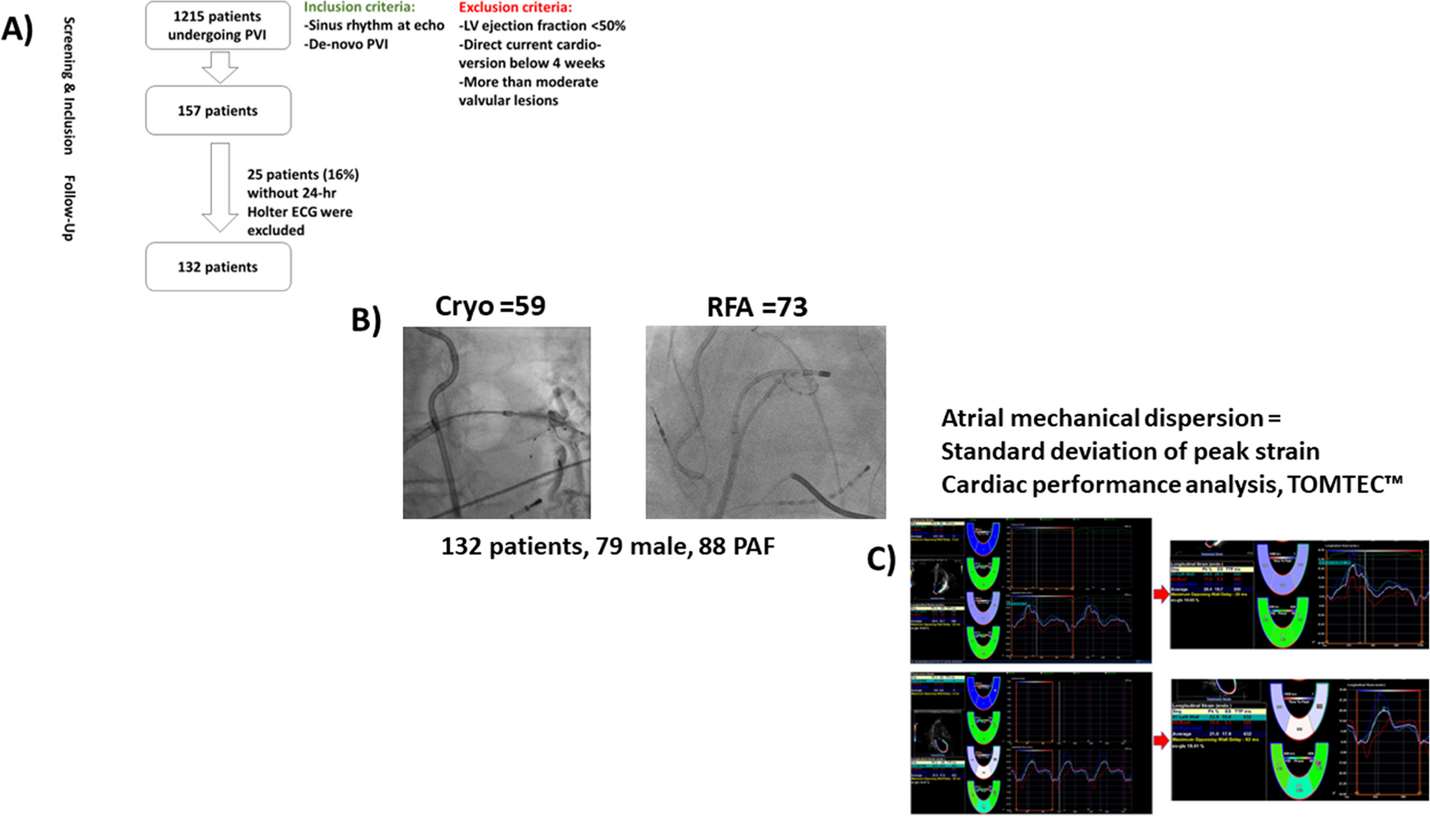 Association of atrial mechanical dispersion with atrial fibrillation recurrence following catheter ablation: results of the ASTRA-AF pilot study